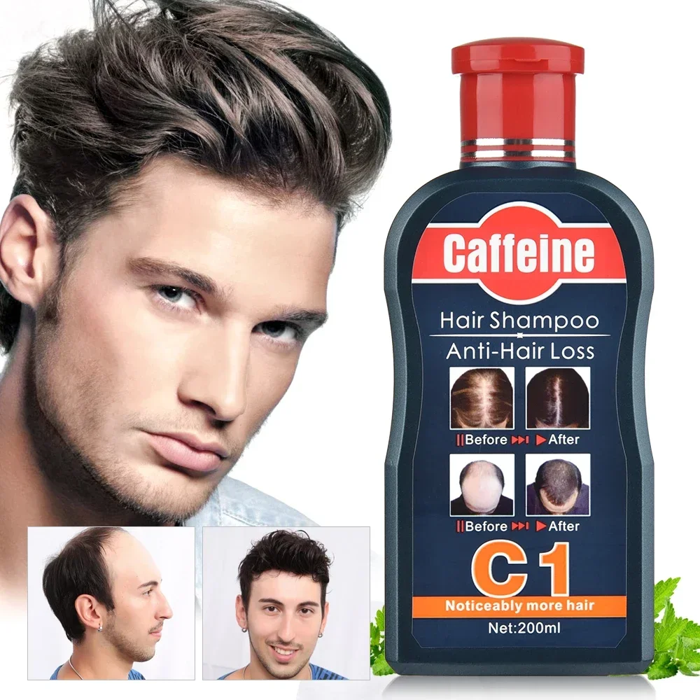 Hair Care Korean Products - Männer Shampoo für das Haar wachstum